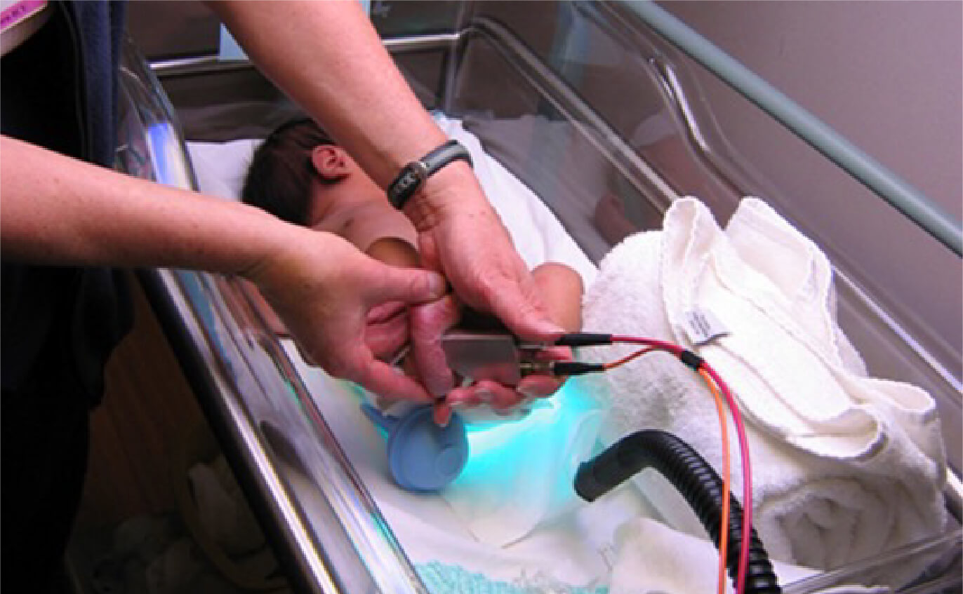 新生児の皮膚カロテノイド量測定（ラマン分光法装置）